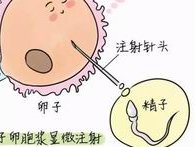 广州试管费用多少？广州哪个医院做试管成功率高？